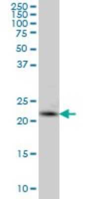 Western Blot: PCTP Antibody (3A11) [H00058488-M03]