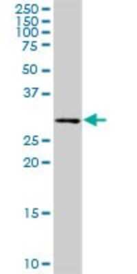 Western Blot: PCTP Antibody [H00058488-D01P]