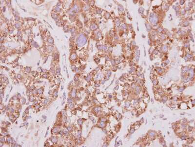 Immunohistochemistry-Paraffin: PCYOX1 Antibody [NBP2-19733]