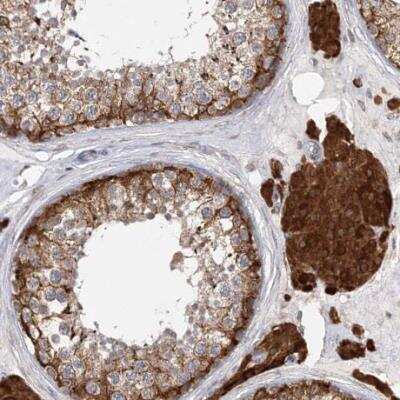 Immunohistochemistry-Paraffin: PCYOX1L Antibody [NBP1-81121]