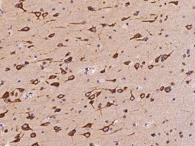 Immunohistochemistry-Paraffin: PCYOX1L Antibody [NBP2-97684]