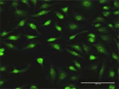 Immunocytochemistry/ Immunofluorescence: PCYT1A Antibody (6E6) [H00005130-M02]
