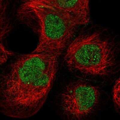 Immunocytochemistry/ Immunofluorescence: PCYT1A Antibody [NBP1-84366]
