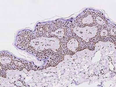 Immunohistochemistry-Paraffin: PCYT1A Antibody [NBP2-97692]