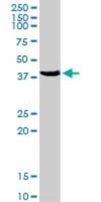 Western Blot: PCYT1A Antibody [H00005130-D01P]