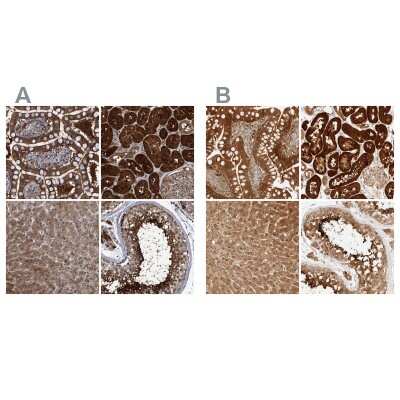 Immunohistochemistry-Paraffin: PCYT2 Antibody [NBP1-83952]