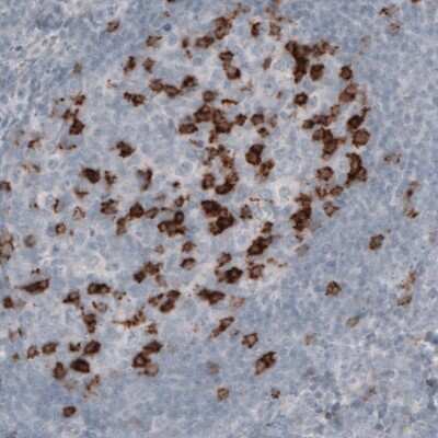 Immunohistochemistry: PD-1 Antibody (CL3624) [NBP2-61625]