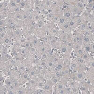 Immunohistochemistry: PD-1 Antibody (CL3624) [NBP2-61625]
