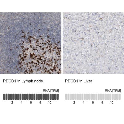 Immunohistochemistry-Paraffin: PD-1 Antibody [NBP1-88104]