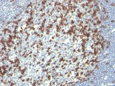 Immunohistochemistry-Paraffin: PD-1 Antibody (PDCD1/922) - Azide and BSA Free [NBP2-47805]