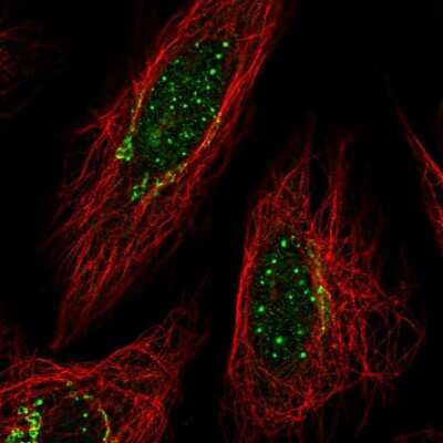 Immunocytochemistry/ Immunofluorescence: PD-ECGF/Thymidine Phosphorylase Antibody [NBP2-55129]