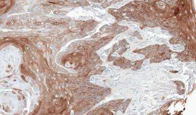 Immunohistochemistry-Paraffin: PD-ECGF/Thymidine Phosphorylase Antibody [NBP1-31458]