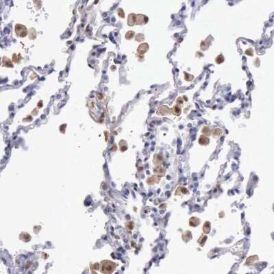 Immunohistochemistry-Paraffin: PD-ECGF/Thymidine Phosphorylase Antibody [NBP1-84916]
