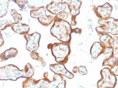Immunohistochemistry-Paraffin: PD-ECGF/Thymidine Phosphorylase Antibody (SPM322) - Azide and BSA Free [NBP2-54403]