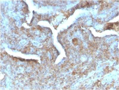Immunohistochemistry-Paraffin: PD-ECGF/Thymidine Phosphorylase Antibody (TYMP/2890R) [NBP3-07281]