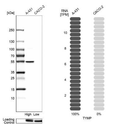 Western Blot: PD-ECGF/Thymidine Phosphorylase Antibody [NBP2-55129]