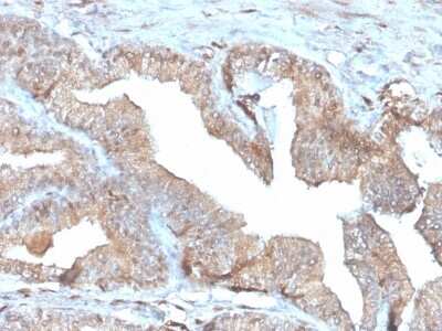 Immunohistochemistry-Paraffin: PD-ECGF/Thymidine Phosphorylase Antibody (rTYMP/3444) - Azide and BSA Free [NBP3-08359]