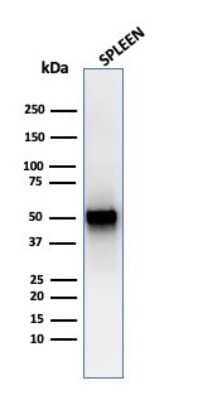 Western Blot: PD-ECGF/Thymidine Phosphorylase Antibody (rTYMP/3444) [NBP3-07270]
