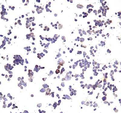Immunocytochemistry/ Immunofluorescence: PD-L1 Antibody (F2G2) - VHH - Azide and BSA Free [NBP3-12826]