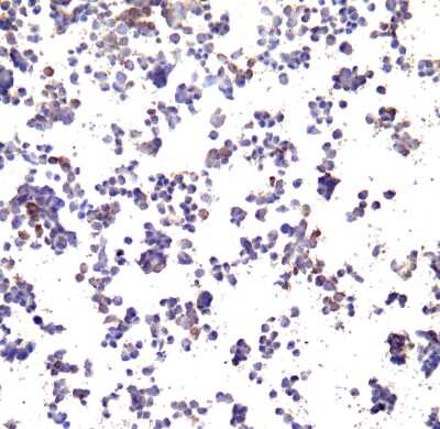 Immunocytochemistry/ Immunofluorescence: PD-L1 Antibody (F6A9) - VHH - Azide and BSA Free [NBP3-12825]