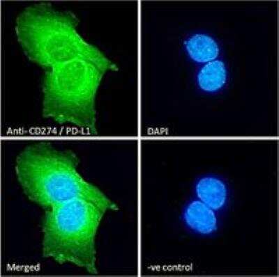 Immunocytochemistry/ Immunofluorescence: PD-L1 Antibody [NB300-903]