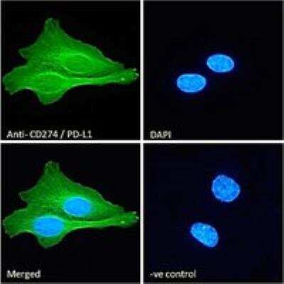 Immunocytochemistry/ Immunofluorescence: PD-L1 Antibody [NB300-903]