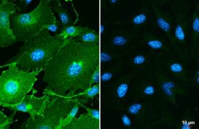 Immunocytochemistry/ Immunofluorescence: PD-L1 Antibody [NBP2-15791]