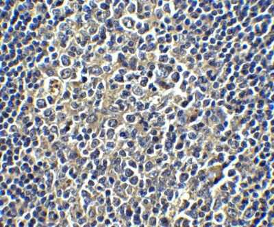 Immunohistochemistry-Paraffin: PD-L1 Antibody - BSA Free [NBP1-76769]