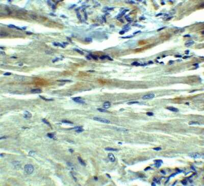 Immunohistochemistry-Paraffin: PD-L1 Antibody - BSA Free [NBP1-76769]