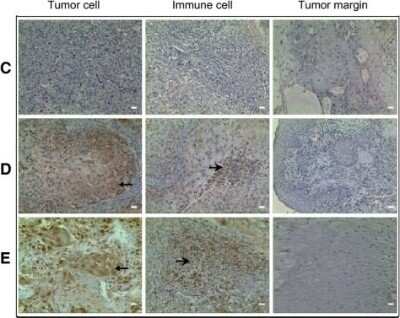 Immunohistochemistry-Paraffin: PD-L1 Antibody - BSA Free [NBP1-76769]