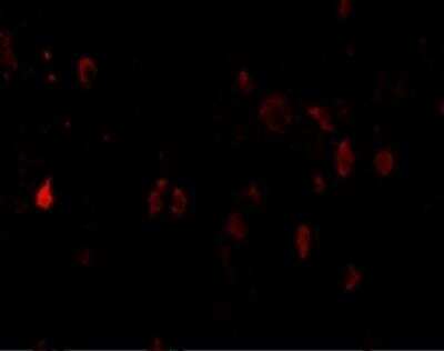Immunocytochemistry/ Immunofluorescence: PD-L2/B7-DC/PDCD1LG2 Antibody - BSA Free [NBP1-76770]