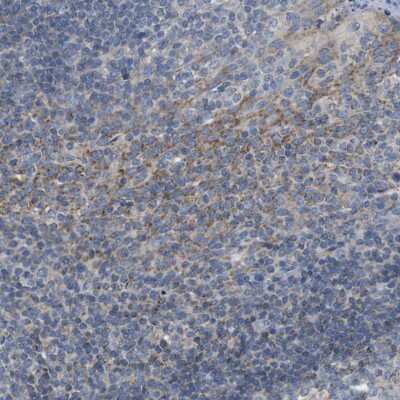 Immunohistochemistry-Paraffin: PD-L2/B7-DC/PDCD1LG2 Antibody [NBP1-88964]