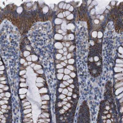 Immunohistochemistry-Paraffin: PD-L2/B7-DC/PDCD1LG2 Antibody [NBP1-88964]