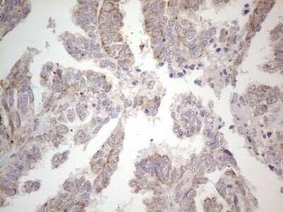Immunohistochemistry: PD-L2/B7-DC/PDCD1LG2 Antibody (OTI7B10) [NBP2-46347]