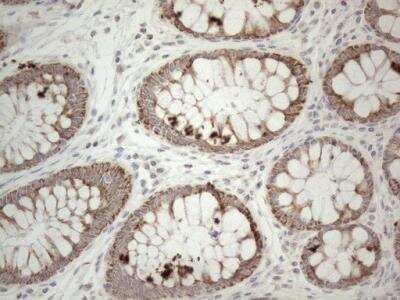 Immunohistochemistry: PD-L2/B7-DC/PDCD1LG2 Antibody (OTI7B10) [NBP2-46347]