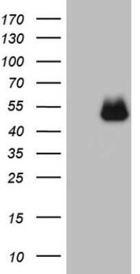 Western Blot: PD-L2/B7-DC/PDCD1LG2 Antibody (OTI7B10) [NBP2-46347]