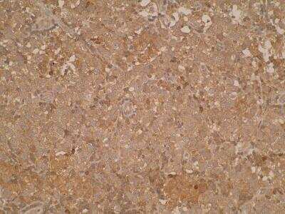 Immunohistochemistry-Paraffin: PD-L2/B7-DC/PDCD1LG2 Antibody (Z64P2D3*H4) - BSA Free [NBP2-52408]
