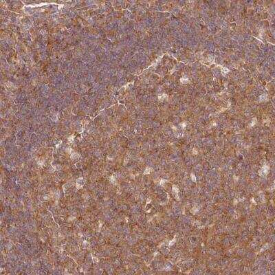 Immunohistochemistry-Paraffin: PDAP1 Antibody [NBP2-38621]