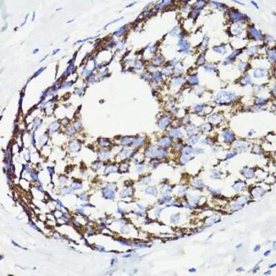 Immunohistochemistry-Paraffin: PDCD10 Antibody - Azide and BSA Free [NBP2-93073]