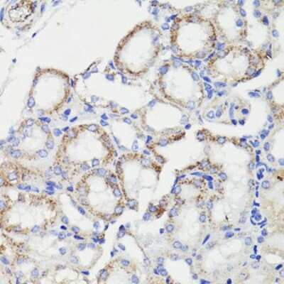 Immunohistochemistry-Paraffin: PDCD10 Antibody - Azide and BSA Free [NBP2-93073]