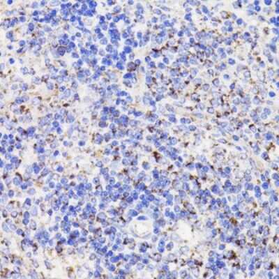 Immunohistochemistry-Paraffin: PDCD10 Antibody - Azide and BSA Free [NBP2-93073]
