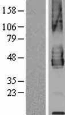 Western Blot: PD-L2/B7-DC/PDCD1LG2 Overexpression Lysate [NBP2-06213]
