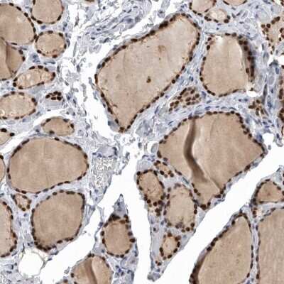 Immunohistochemistry-Paraffin: PDCD4 Antibody [NBP1-83301]