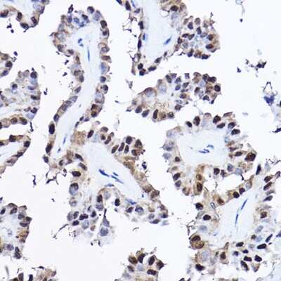 Immunohistochemistry-Paraffin: PDCD4 Antibody - BSA Free [NBP3-03401]