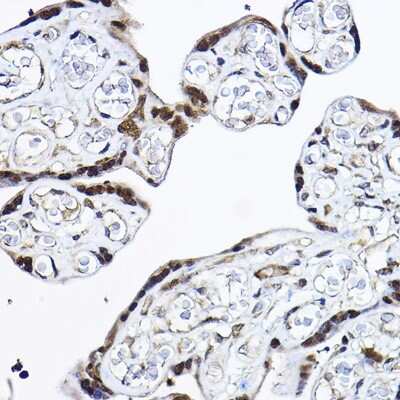 Immunohistochemistry-Paraffin: PDCD4 Antibody - BSA Free [NBP3-03401]