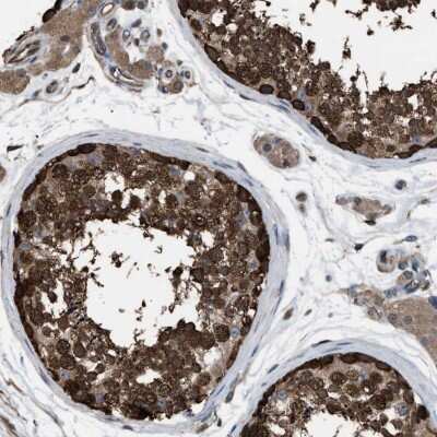 Immunohistochemistry-Paraffin: PDCD5 Antibody [NBP1-82656]