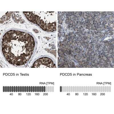 Immunohistochemistry-Paraffin: PDCD5 Antibody [NBP1-82656]