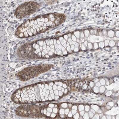 Immunohistochemistry-Paraffin: PDCL3 Antibody [NBP1-80626]