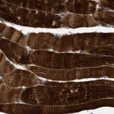 Immunohistochemistry-Paraffin: PDCL3 Antibody [NBP1-80627]