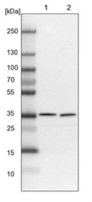 Western Blot: PDCL3 Antibody [NBP1-80626]